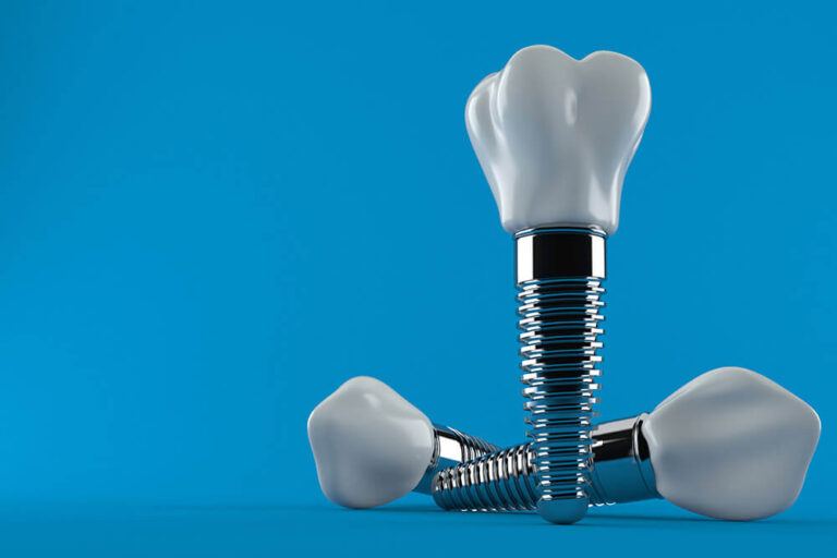 types-of-dental-implants