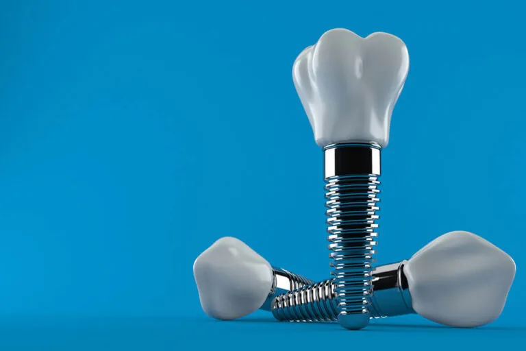 types-of-dental-implants
