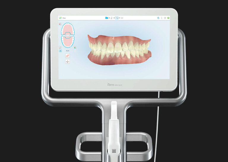 iteroscanner