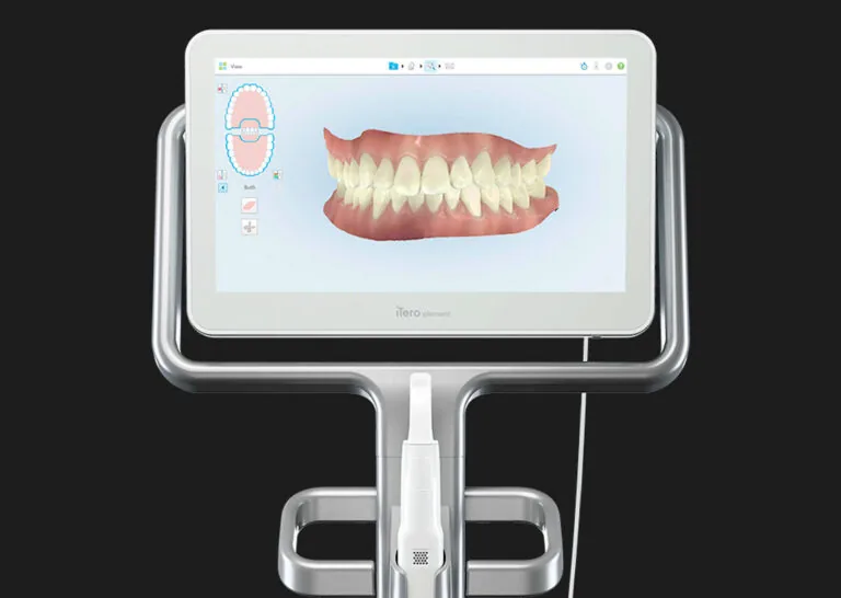 iteroscanner