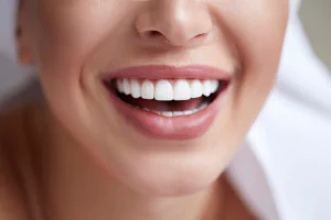 Dental veneers frequently asked questions at Meadowbrook Family Dental in Elk Grove, CA